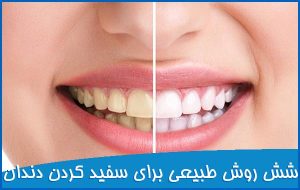 شش روش طبیعی برای سفید کردن دندان ها